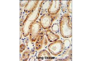 GALNT5 Antibody IHC analysis in formalin fixed and paraffin embedded human normal lung tissue followed by peroxidase conjugation of the secondary antibody and DAB staining. (GALNT5 抗体  (N-Term))