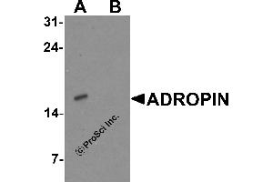 Western Blotting (WB) image for anti-Energy Homeostasis Associated (ENHO) (C-Term) antibody (ABIN2457882) (ENHO 抗体  (C-Term))