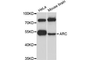Western blot analysis of extracts of various cell lines, using ARC antibody (ABIN5995970) at 1:3000 dilution. (ARC 抗体)