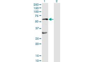 Western Blot analysis of EPOR expression in transfected 293T cell line by EPOR monoclonal antibody (M01), clone 3D10. (EPOR 抗体  (AA 31-130))