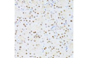 Immunohistochemistry of paraffin-embedded rat pancreas using ETV1 antibody (ABIN6129794, ABIN6140327, ABIN6140329 and ABIN6217250) at dilution of 1:100 (40x lens). (ETV1 抗体  (AA 80-300))