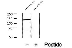 Western blot analysis of extracts of mouse spleen tissue, using HPS5 antibody.