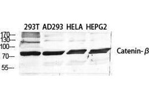 Western Blot (WB) analysis of specific cells using Catenin-beta Polyclonal Antibody. (beta Catenin 抗体  (Ser289))