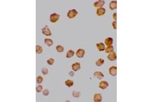 Immunocytochemistry staining of HeLa cells using AP30280PU-N DcR2 antibody at 10μg/ml.