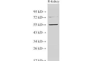 Western Blot analysis of Rat kidney using TGFBR1 Polyclonal Antibody at dilution of 1:1000 (TGFBR1 抗体)