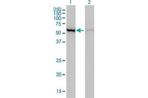 Western Blotting (WB) image for anti-Cystathionine-beta-Synthase (CBS) (AA 1-100) antibody (ABIN7489109)