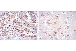 Immunohistochemistry (IHC) image for anti-Heat Shock Protein 90kDa alpha (Cytosolic), Class B Member 1 (HSP90AB1) antibody (ABIN969202)