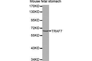 Western blot analysis of extracts of mouse fetal stomach, using TRAF7 antibody (ABIN5971582). (TRAF7 抗体)