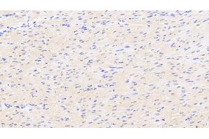 Detection of DKK2 in Human Cardiac Muscle Tissue using Polyclonal Antibody to Dickkopf Related Protein 2 (DKK2) (DKK2 抗体  (AA 159-258))