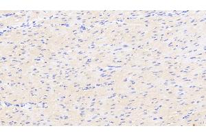 Detection of DKK2 in Human Cardiac Muscle Tissue using Polyclonal Antibody to Dickkopf Related Protein 2 (DKK2) (DKK2 抗体  (AA 159-258))