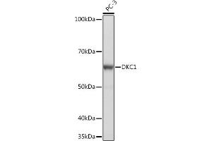 Western blot analysis of extracts of PC-3 cells, using DKC1 Rabbit mAb (ABIN7266869) at 1:1000 dilution. (DKC1 抗体)