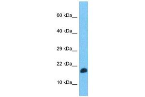 Western Blotting (WB) image for anti-Transcription Elongation Factor, Mitochondrial (TEFM) (N-Term) antibody (ABIN2790957)