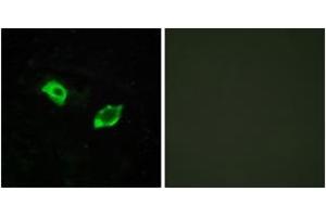 Immunofluorescence analysis of HuvEc cells, using GPR158 Antibody. (GPR158 抗体  (AA 1-50))