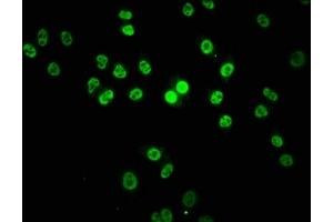 Immunofluorescence staining of Hela cells with ABIN7155462 at 1:133, counter-stained with DAPI. (Lysine (K)-Specific Methyltransferase 2B (KMT2B) (AA 145-290) 抗体)