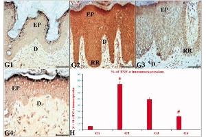 The effects of ustekinumab and the CUC on the immunoexpression (IE) of TNF-α in IQ-induced psoriatic skin lesions. (TNF alpha 抗体)