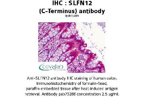 Image no. 2 for anti-Schlafen Family Member 12 (SLFN12) (C-Term) antibody (ABIN1739425) (SLFN12 抗体  (C-Term))