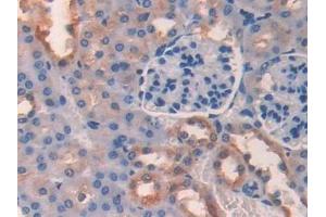 Immunohistochemistry (IHC) image for anti-Paraoxonase 2 (PON2) (AA 4-289) antibody (ABIN7440995)