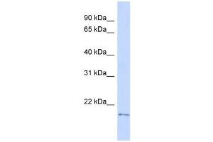 WB Suggested Anti-TGIF2LY Antibody Titration:  0. (TGIF2LY 抗体  (Middle Region))