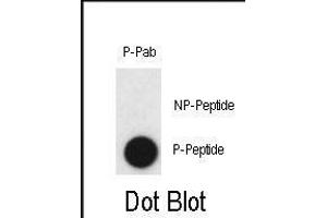 Dot blot analysis of anti-Phospho-CLDN2-p Antibody (ABIN390022 and ABIN2839781) on nitrocellulose membrane. (Claudin 2 抗体  (pTyr224))