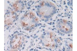 DAB staining on IHC-P; Samples: Human Stomach Tissue (LPHN3 抗体  (AA 1105-1447))