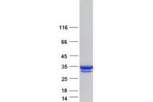 Western Blotting (WB) image for Catechol-O-Methyltransferase (COMT) (Transcript Variant 1) protein (Myc-DYKDDDDK Tag) (ABIN2712474)