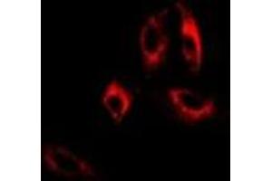 Immunofluorescent analysis of GAD2 staining in A549 cells.