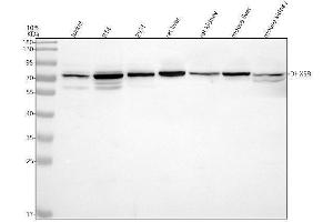 Western blot analysis of DHX58 using anti-DHX58 antibody (ABIN7825337).