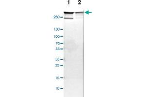 Western blot analysis of Lane 1: NIH-3T3 cell lysate (Mouse embryonic fibroblast cells), Lane 2: NBT-II cell lysate (Rat Wistar bladder tumour cells) with FLNA polyclonal antibody  at 1:100-1:500 dilution. (Filamin A 抗体)