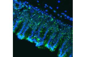 anti-Claudin 18 (CLDN18) (AA 31-261) antibody