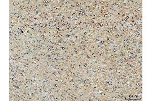 IHC analysis of PPP2CA using anti-PPP2CA antibody (ABIN3043356).