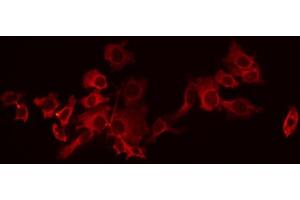 ABIN6266542 staining HeLa by IF/ICC. (GABBR1 抗体  (C-Term))