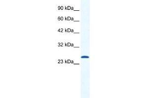 WB Suggested Anti-CACNG6 Antibody Titration:  1. (CACNG6 抗体  (N-Term))