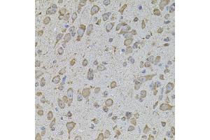 Immunohistochemistry (IHC) image for anti-Collagen, Type I, alpha 2 (COL1A2) antibody (ABIN6570116)