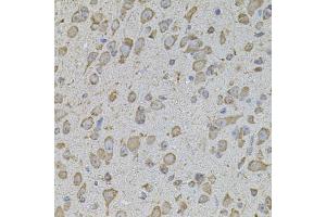 Immunohistochemistry of paraffin-embedded mouse brain using COL1A2 antibody. (COL1A2 抗体)