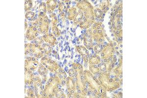 Immunohistochemistry of paraffin-embedded rat kidney using HSPA9 antibody at dilution of 1:200 (400x lens). (HSPA9 抗体)