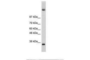 Image no. 3 for anti-Deleted In Azoospermia 4 (DAZ4) (N-Term) antibody (ABIN6736264) (DAZ4 抗体  (N-Term))