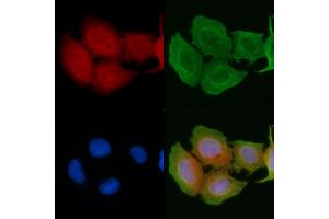 ABIN6256923 and ABIN6274414 staining Hela cells(45 min of heat-shock) by IF/ICC. (ADCK1 抗体  (Internal Region))