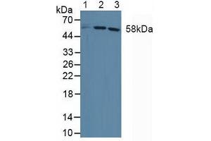 Western blot analysis of (1) Human HepG2 Cells, (2) Human Jurkat Cells and (3) Human HeLa cells. (DKC1 抗体  (AA 298-465))