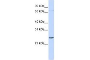 Image no. 1 for anti-PR Domain Containing 5 (PRDM5) (C-Term) antibody (ABIN6742850) (PRDM5 抗体  (C-Term))
