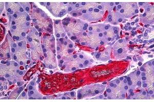Rat Pancreas, Vessel: Formalin-Fixed, Paraffin-Embedded (FFPE) (RECA-1 抗体)