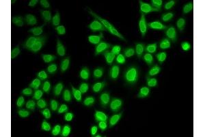 Immunofluorescence analysis of MCF-7 cells using RanG antibody (ABIN6128613, ABIN6146681, ABIN6146683 and ABIN6217306). (RANGAP1 抗体  (AA 398-587))