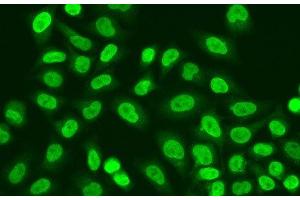 Immunofluorescence analysis of A549 cells using POLR2J Polyclonal Antibody (POLR2J 抗体)
