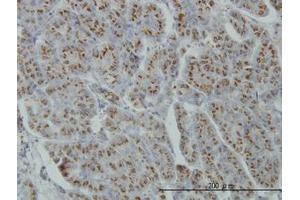 Image no. 1 for anti-Mannosyl (Alpha-1,3-)-Glycoprotein beta-1,4-N-Acetylglucosaminyltransferase, Isozyme A (MGAT4A) (AA 436-536) antibody (ABIN599178) (MGAT4A 抗体  (AA 436-536))