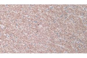 Detection of ELA1 in Human Cerebrum Tissue using Polyclonal Antibody to Pancreatic Elastase 1 (ELA1) (CELA1 抗体  (AA 40-258))