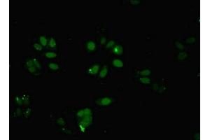 Immunofluorescent analysis of HepG2 cells using ABIN7145824 at dilution of 1:100 and Alexa Fluor 488-congugated AffiniPure Goat Anti-Rabbit IgG(H+L) (BRD9 抗体  (AA 338-597))