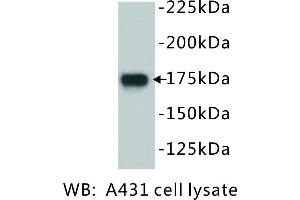 Image no. 1 for anti-Epidermal Growth Factor Receptor (EGFR) antibody (ABIN1112884) (EGFR 抗体)