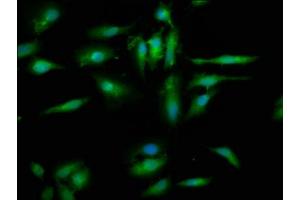 Immunofluorescence staining of Hela cells with ABIN7152365 at 1:200, counter-stained with DAPI. (EYA4 抗体  (AA 153-224))