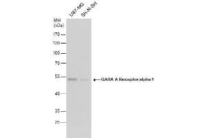 WB Image GABA A Receptor alpha 1 antibody detects GABA A Receptor alpha 1 protein by western blot analysis. (GABRA1 抗体  (Center))