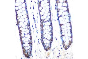 Immunohistochemistry (IHC) image for anti-COP9 Constitutive Photomorphogenic Homolog Subunit 5 (Arabidopsis) (COPS5) antibody (ABIN7266497)