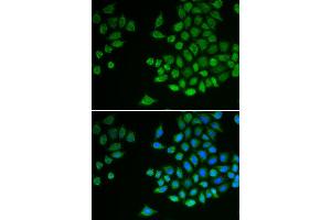 Immunofluorescence analysis of MCF-7 cell using PTPN2 antibody. (PTPN2 抗体)